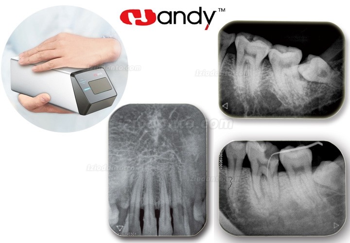 Handy HDS-500 PSP Scanner Dental Rx Placa De Fosforo Odontológica